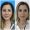 mediface-eyelid-surgery-turkey-antalya.jpg